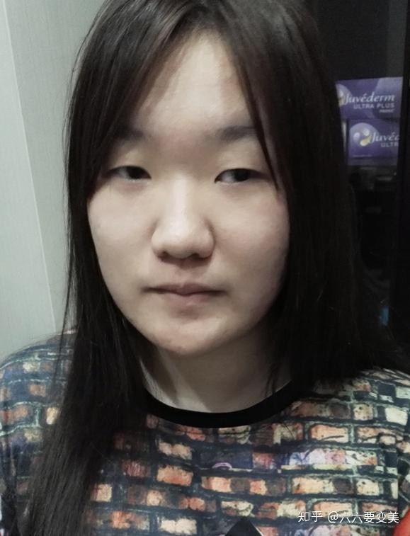 单眼皮的姑娘真的就比双眼皮姑娘丑吗