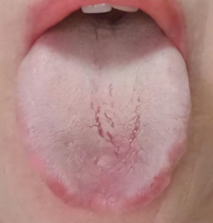 身体好不好看舌头就知道肝郁气滞痰多脾胃虚弱肾气亏虚