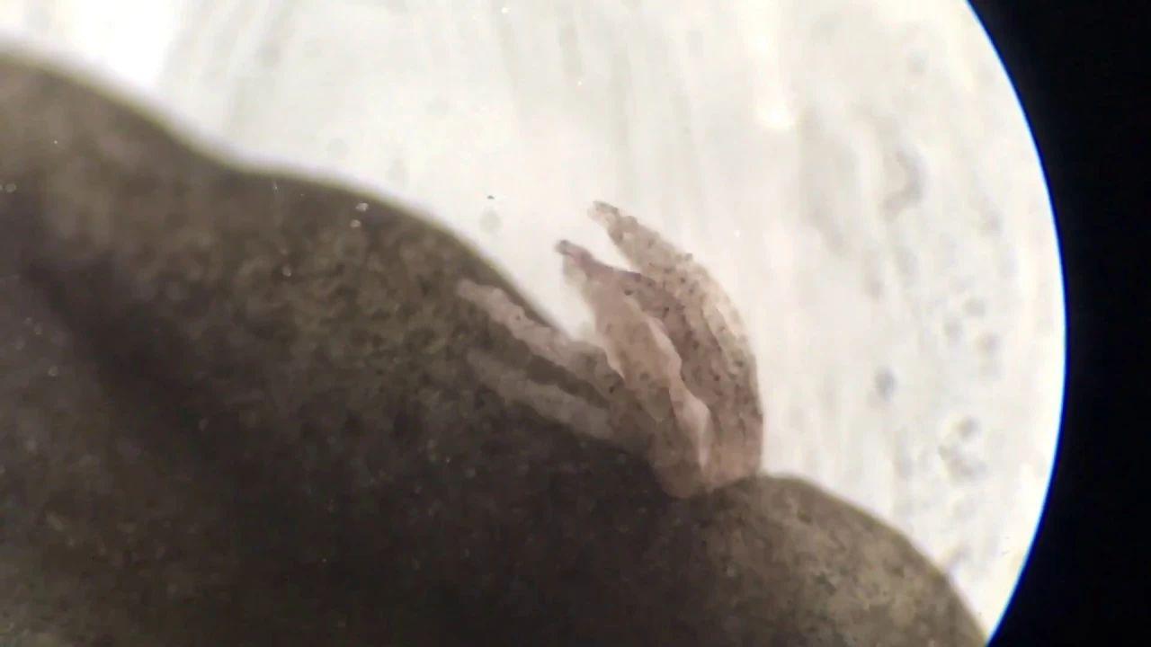 蝌蚪的外鳃这种保护机制也传给了人类,可人类已经没有了鳃,当这种保护