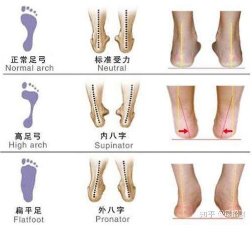 亚瑟士asics鞋的内翻外翻脚型该怎么选
