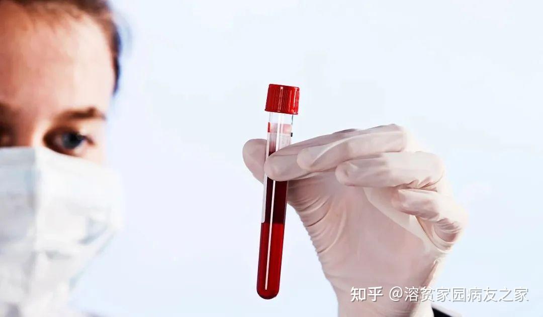 自身免疫性溶血性贫血,Coombs试验为何阴性? - 知乎