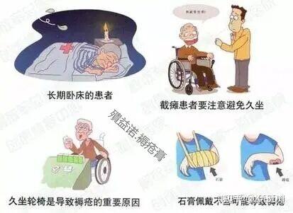 压疮的发生原因和危害! - 知乎