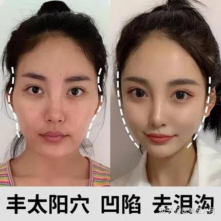 脸颊凹陷女人面相图片