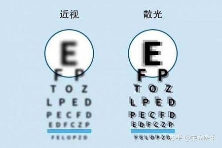 近视和散光有哪些区别 - 知乎
