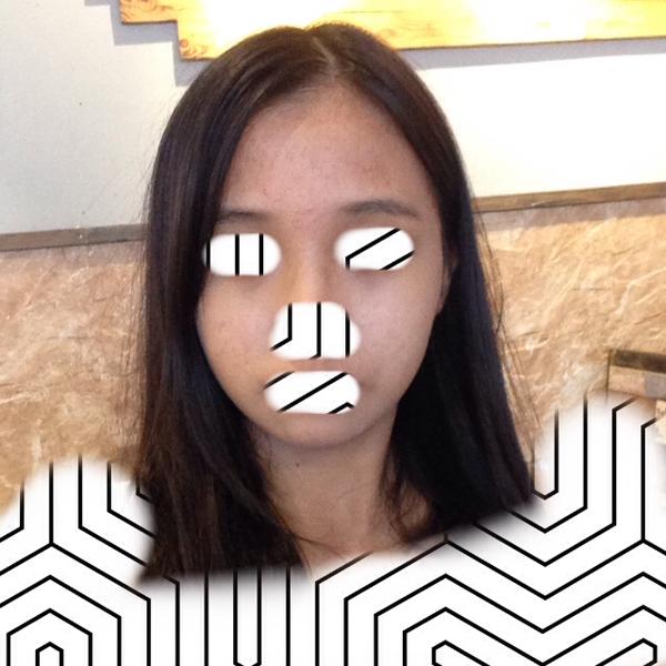 这是现在的样子!!!(2017年7月的)已经好很多了,没有特别特别明显的