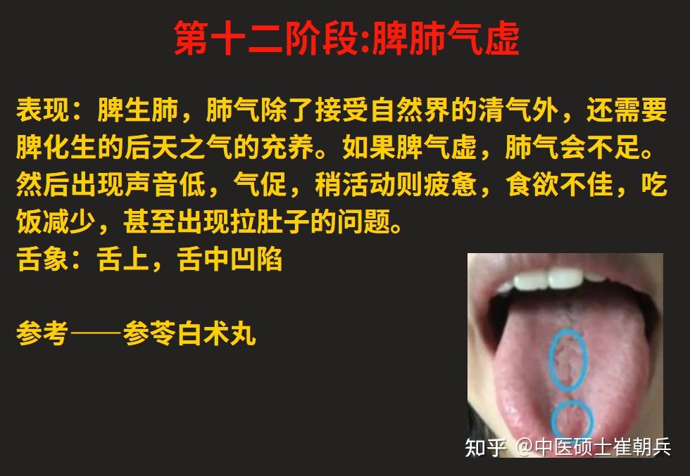 脾气虚、脾阳虚,由轻到重,看看自己的脾虚在哪个阶段?12个阶段的脾虚一次讲明白 - 知乎