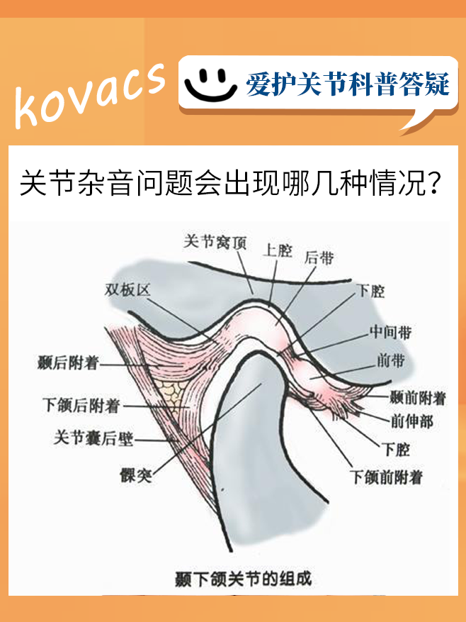 颞下颌关节紊乱相关的伴发症状 - 知乎