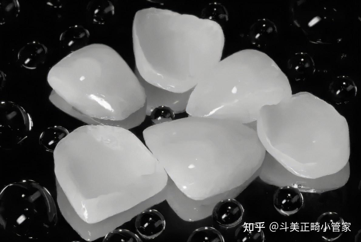 广州,深圳,佛山牙齿贴面价格,医院选择,2022年超全最新攻略! - 知乎