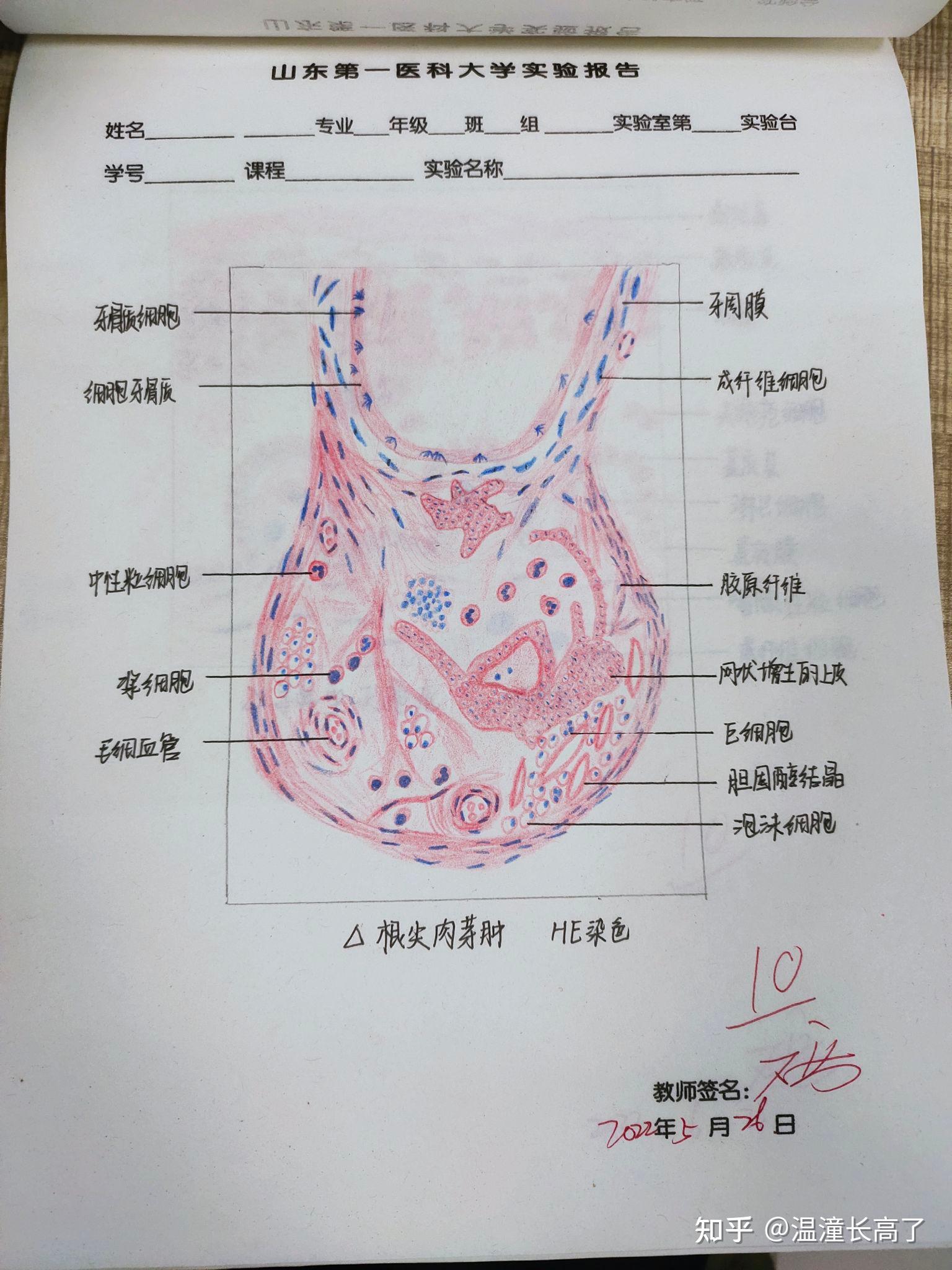 钟状期成釉器红蓝绘图图片