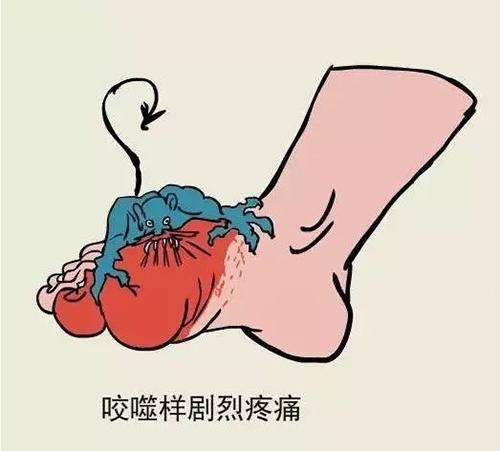 老年朋友患痛风应该怎么治疗才好