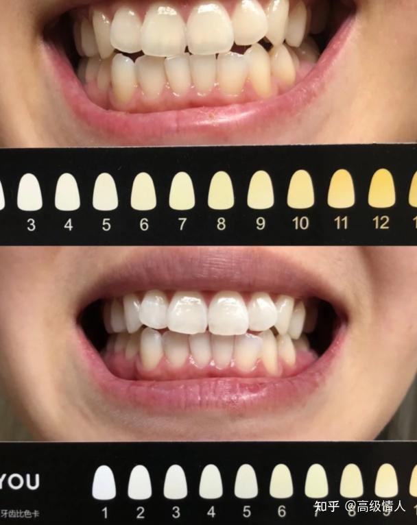 有没有相见恨晚的好物推荐