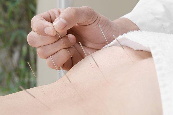 颈椎病如何针灸治疗针灸还可以治疗哪些疾病