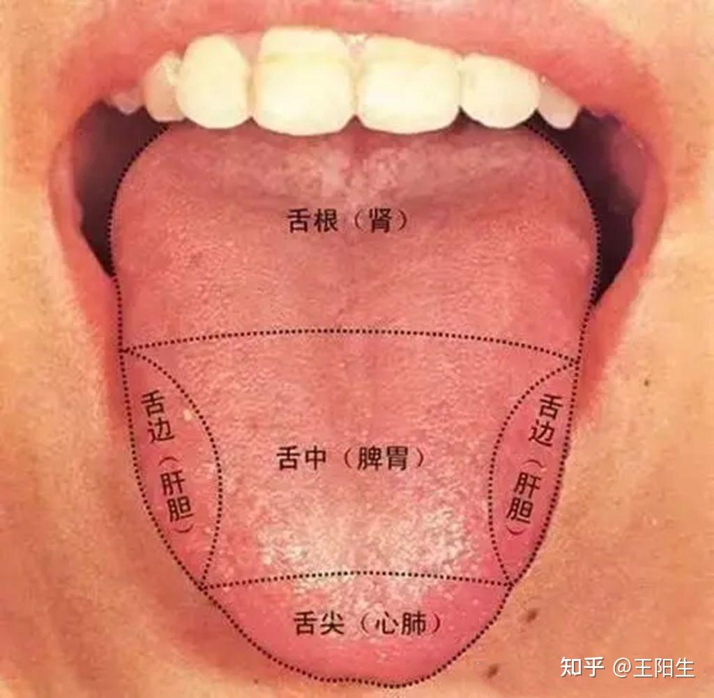 舌有裂纹就是阴虚？四种裂纹舌，十种舌象看看你是属于哪一种？ | Foodlife