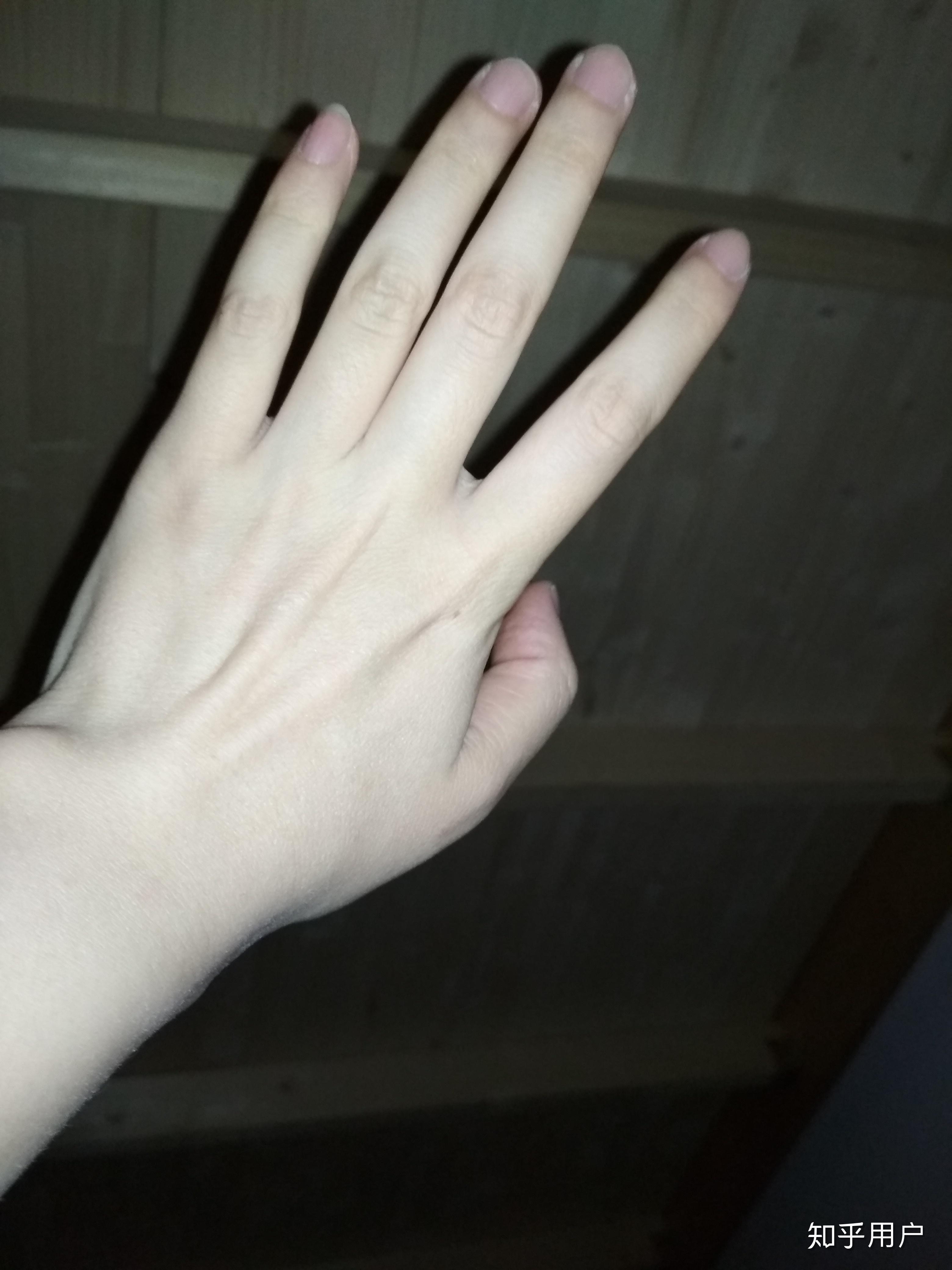 中国有真正冷白皮的人吗