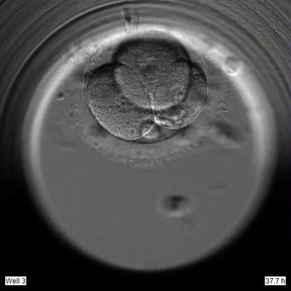 生不出娃,原因可不止是年龄!