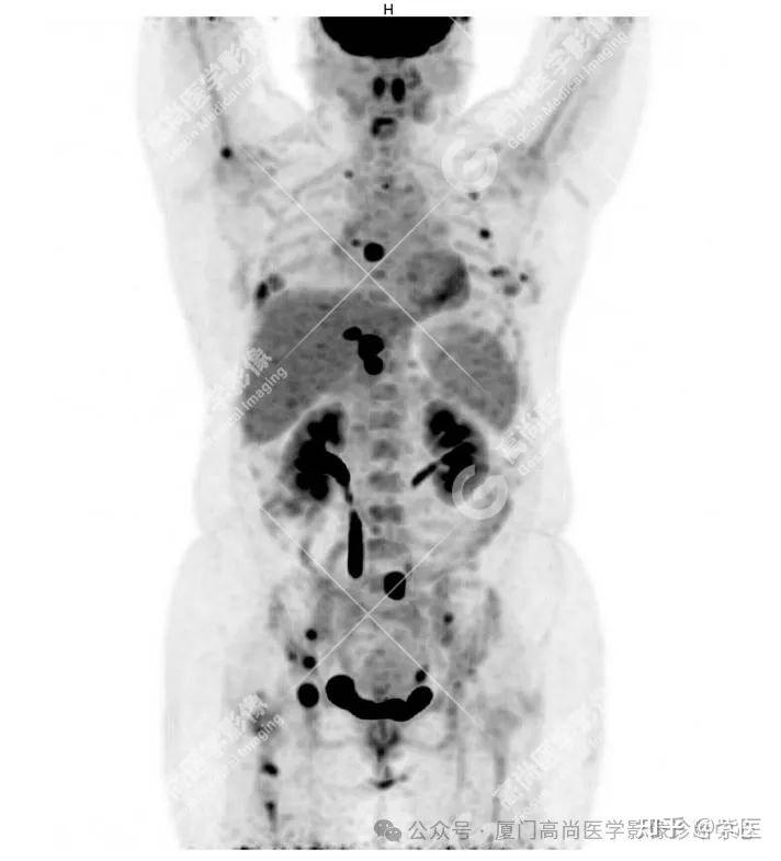 v2-5c9aa1847b5c4b08f0b2be105324952d_r.jpg?source=1def8aca