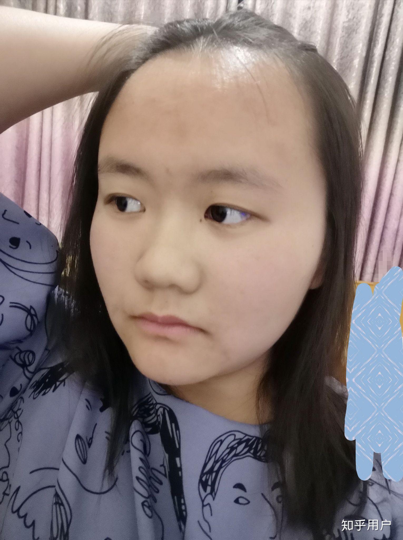女生发际线特别高是怎样的体验