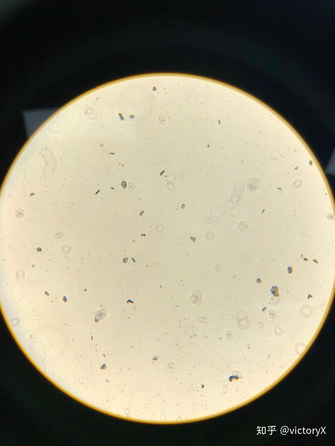 那说明黑胶虫不存在只是细胞培养中的真菌感染,还是说明黑胶虫污染