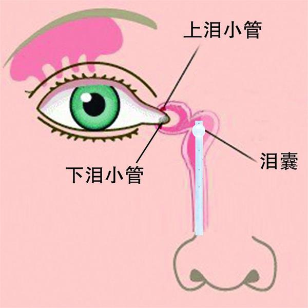 泪囊炎的形成 - 知乎
