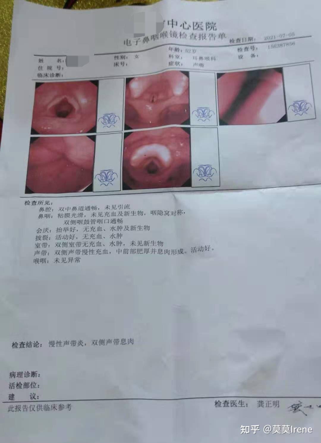 有没有大神声带息肉没有手术好了的? - 知乎