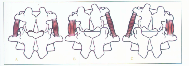 青城山下白素贞  =《深入浅出筋膜学》=> 体侧线理论篇(i) - 知乎