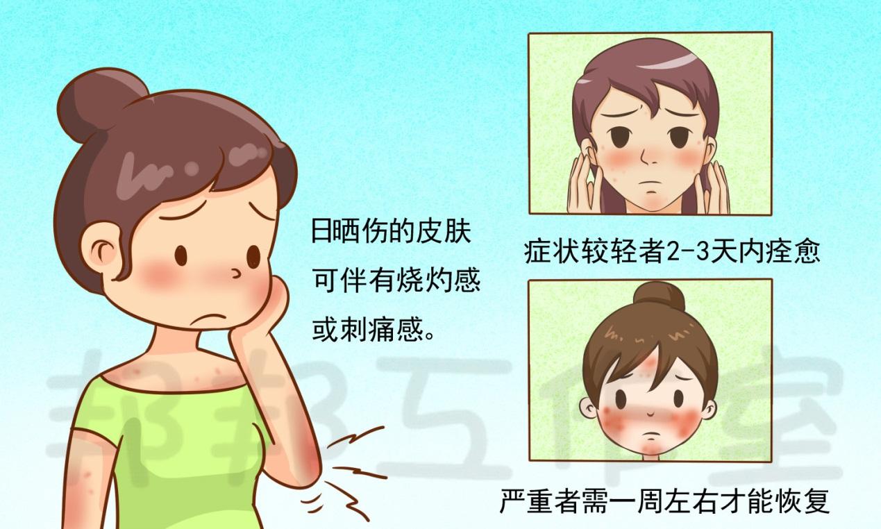 夏天皮肤晒伤了怎么办