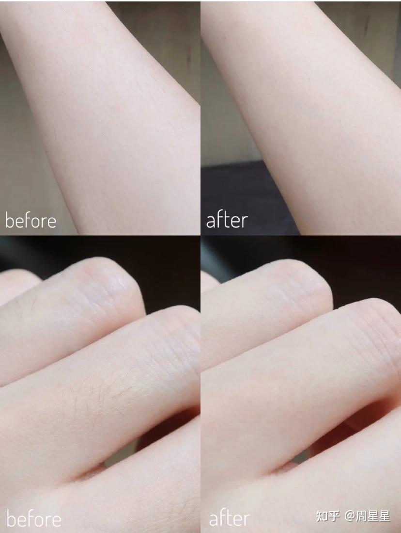 家用脱毛仪只选对的不选贵的亲测慕金ulike飞利浦jovs小猫安妮五款