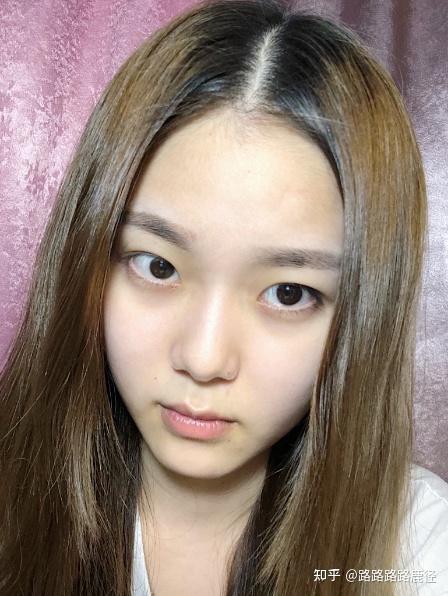 成都割双眼皮医院医生哪里好单眼皮变双眼皮改变太大了