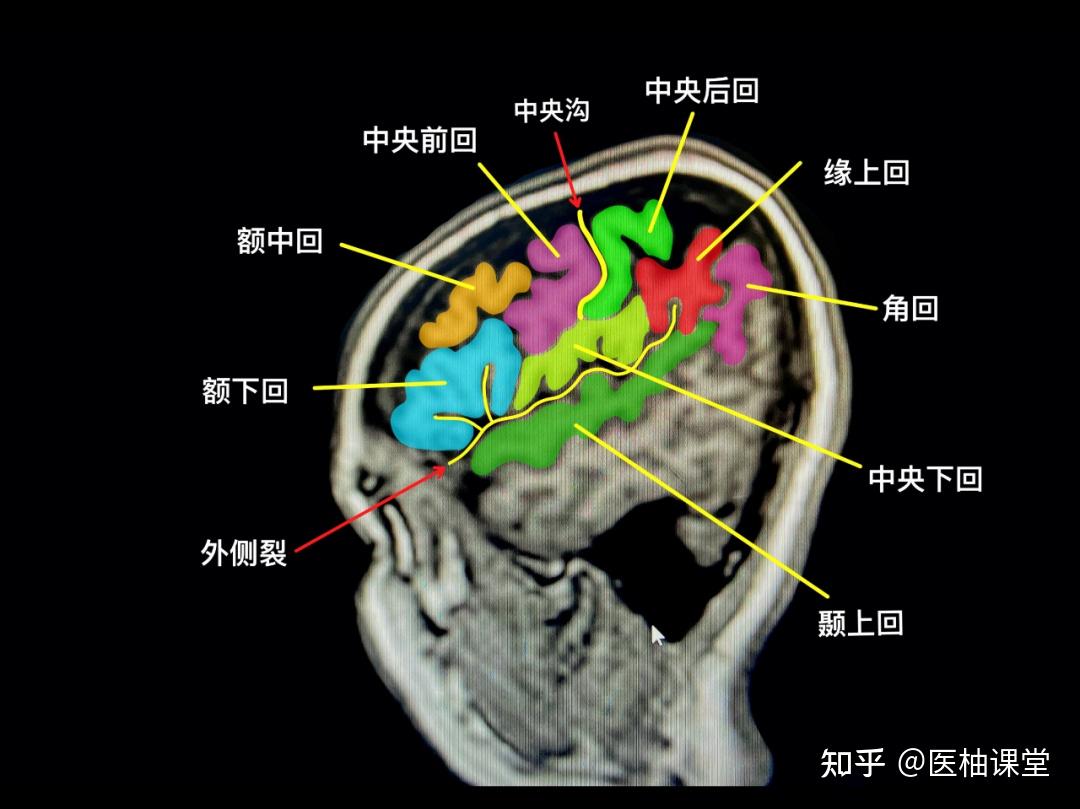 头颅MR阅片手绘(精华版) - 知乎