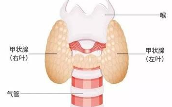 甲状腺囊肿有什么表现 病因有哪些 知乎