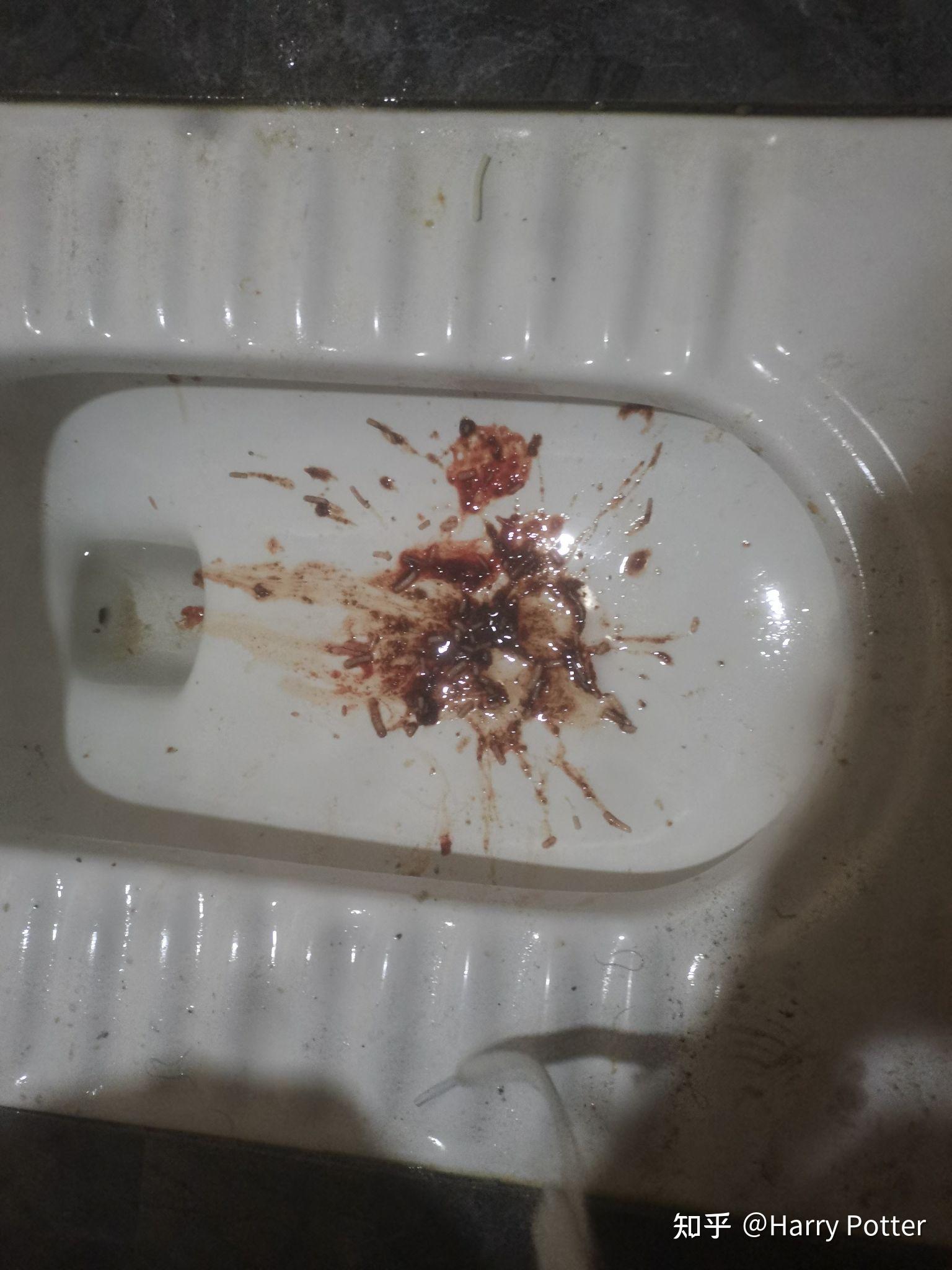 喝酒吐血是怎么回事?