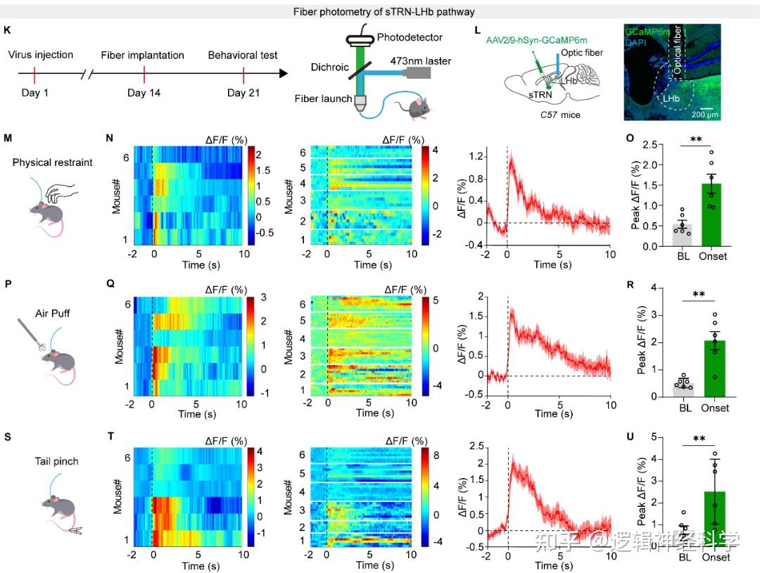 Cell Reports︱中国科学技术大学张艳/刘新峰/北京大学张瑛团队揭示慢性压力引起外侧缰核高活性致抑郁的神经机制 - 知乎
