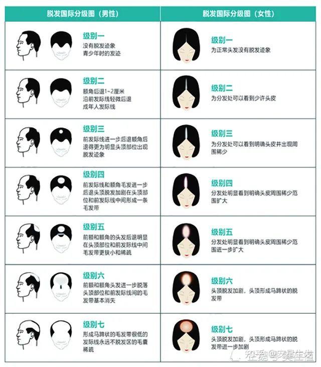 因为秃顶让个体看起来比实际年龄显老,好多年轻小伙在择偶方面都有