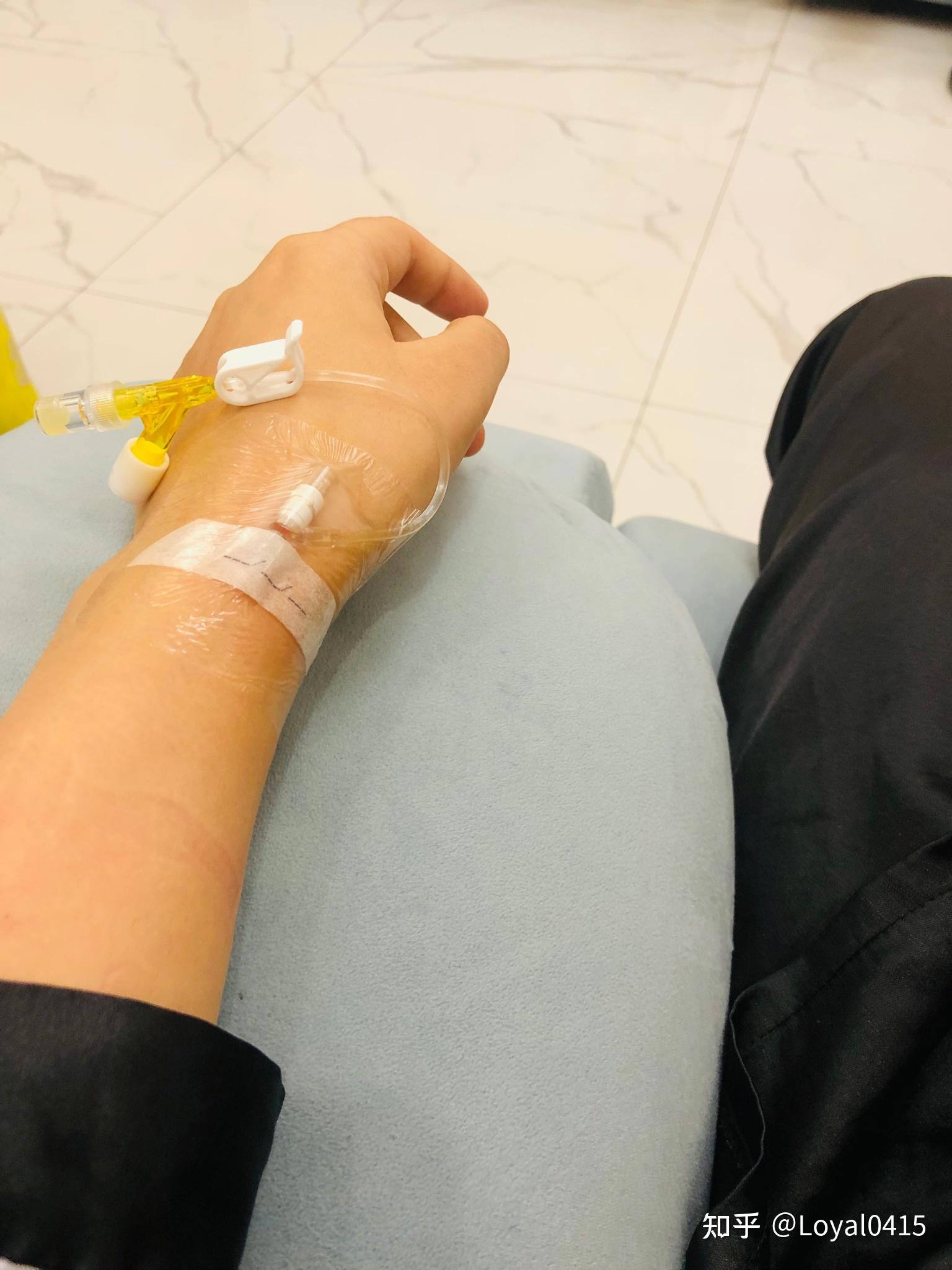 一台9:00的手术,8:30医院上班,开始带头套,换衣服,抽血,填表,扎滞留针