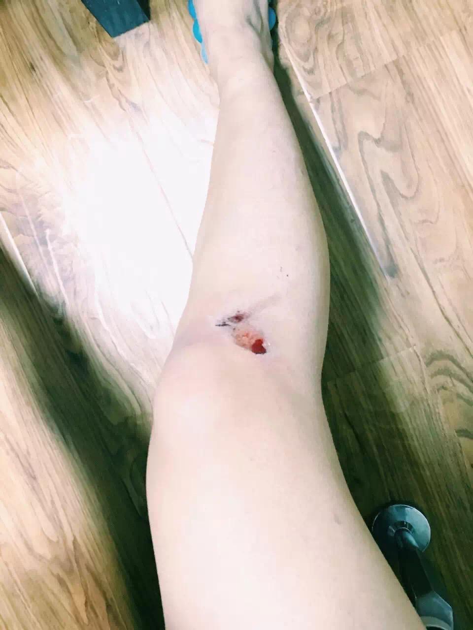 玩滑板摔倒是一种怎样的体验