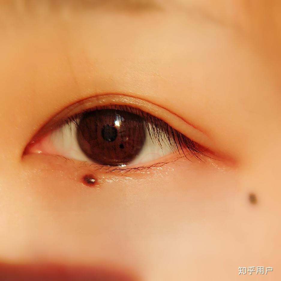 历史上的重瞳子是真实存在的吗?两个瞳仁在眼睛里是如何分布的?