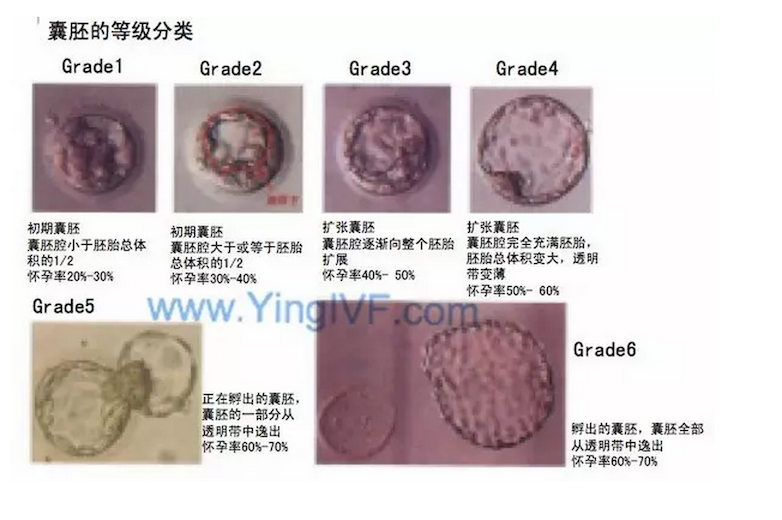 带你看看受精卵怎么培养 胚胎怎么评级