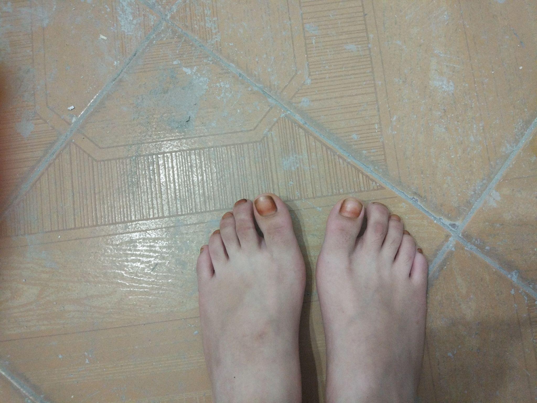 为什么有些人的脚趾是直的而我的是弯的