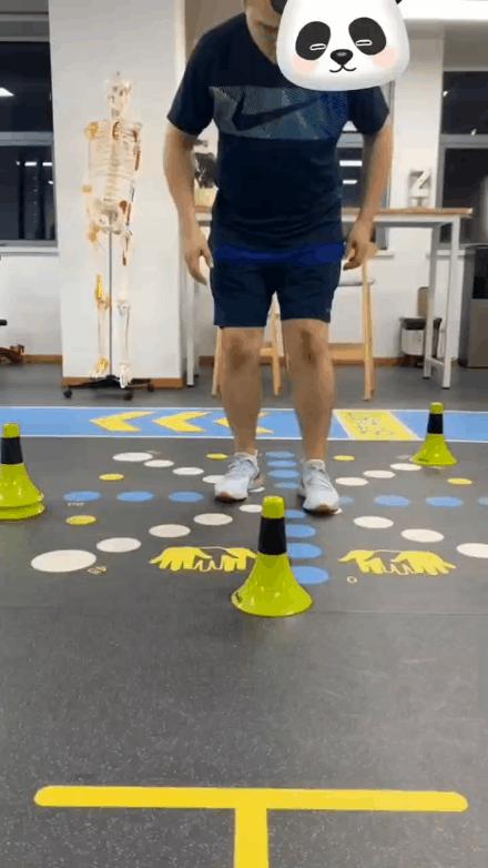 精选案例|髌骨骨折术后,自我康复两个月无成效?