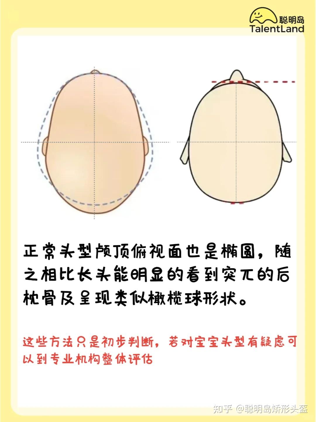 如何判断宝宝头型是不是长头舟状头 - 知乎