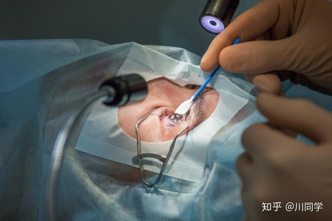 我x有散光神烦有什么方法改善他