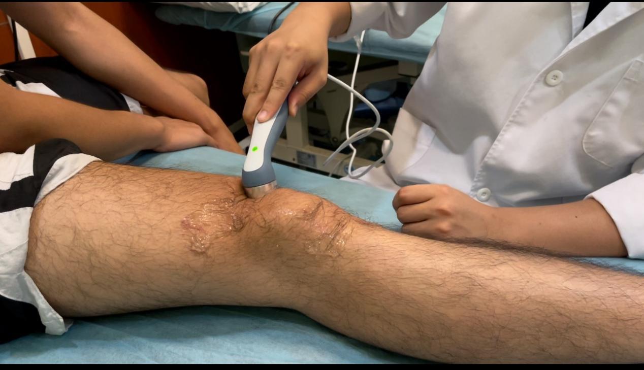 前叉重建肌肉萎缩该怎么练