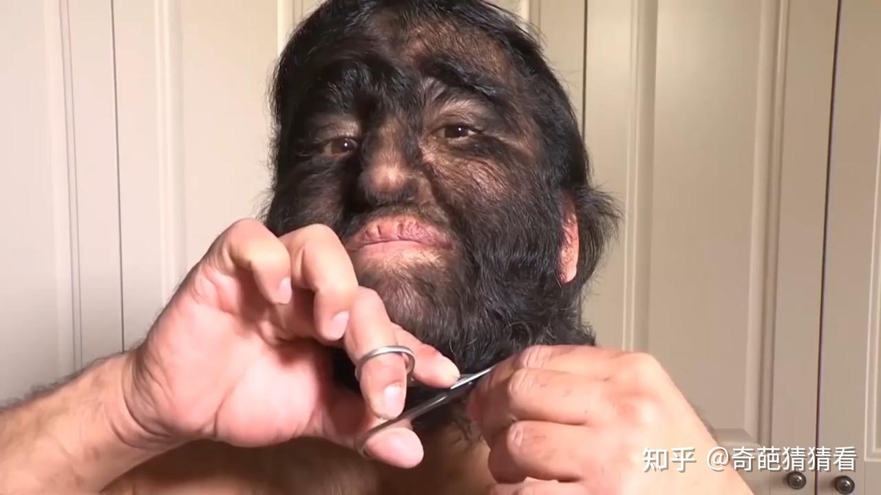 女生多毛是一种怎样的体验? - 知乎