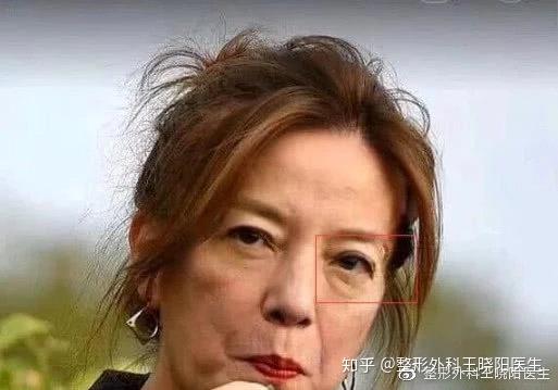 从赵薇谈整容说起,那些把自己特色整没的女明星到底想什么?