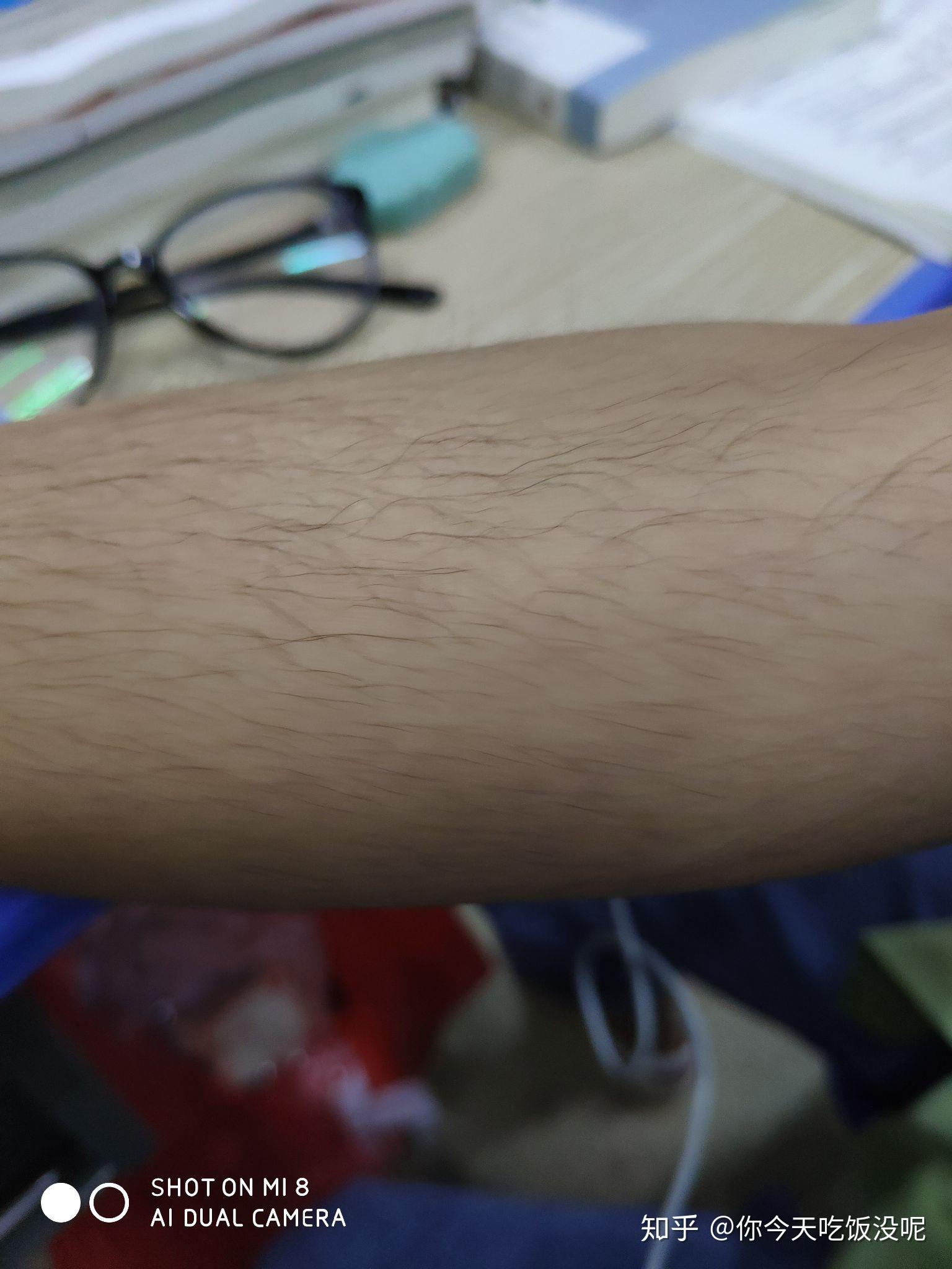 女生长浓密手毛是一种什么样的体验