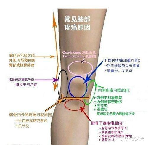 如何预防膝盖关节疼痛 知乎