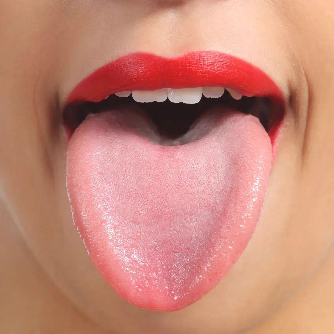 正常人的舌头两侧图片图片