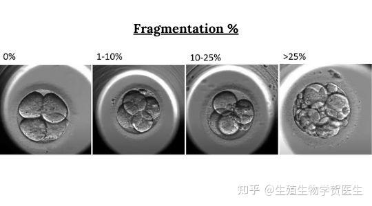 4cc級別的囊胚移植成功率高麼