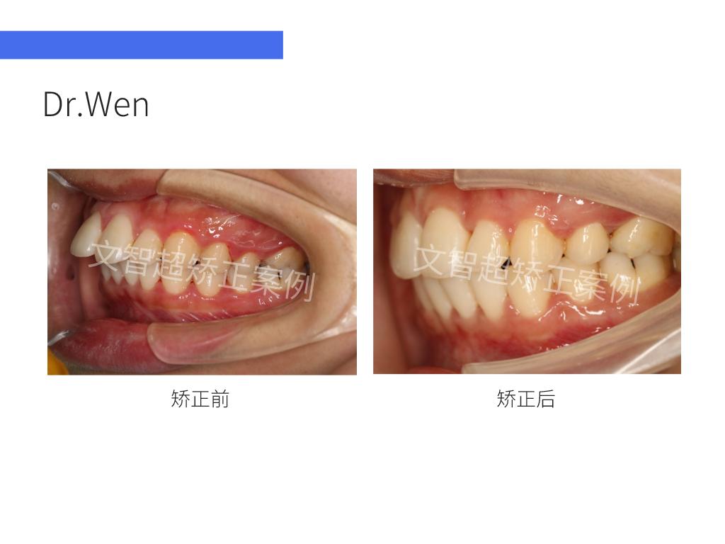 v2-5f87e136c06474a32c5edffbfa1a8696_1440w.jpg?source=172ae18b