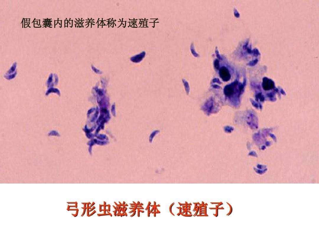弓形虫又是单细胞生物,其活动范围只在于大多数温血动物的有核细胞内